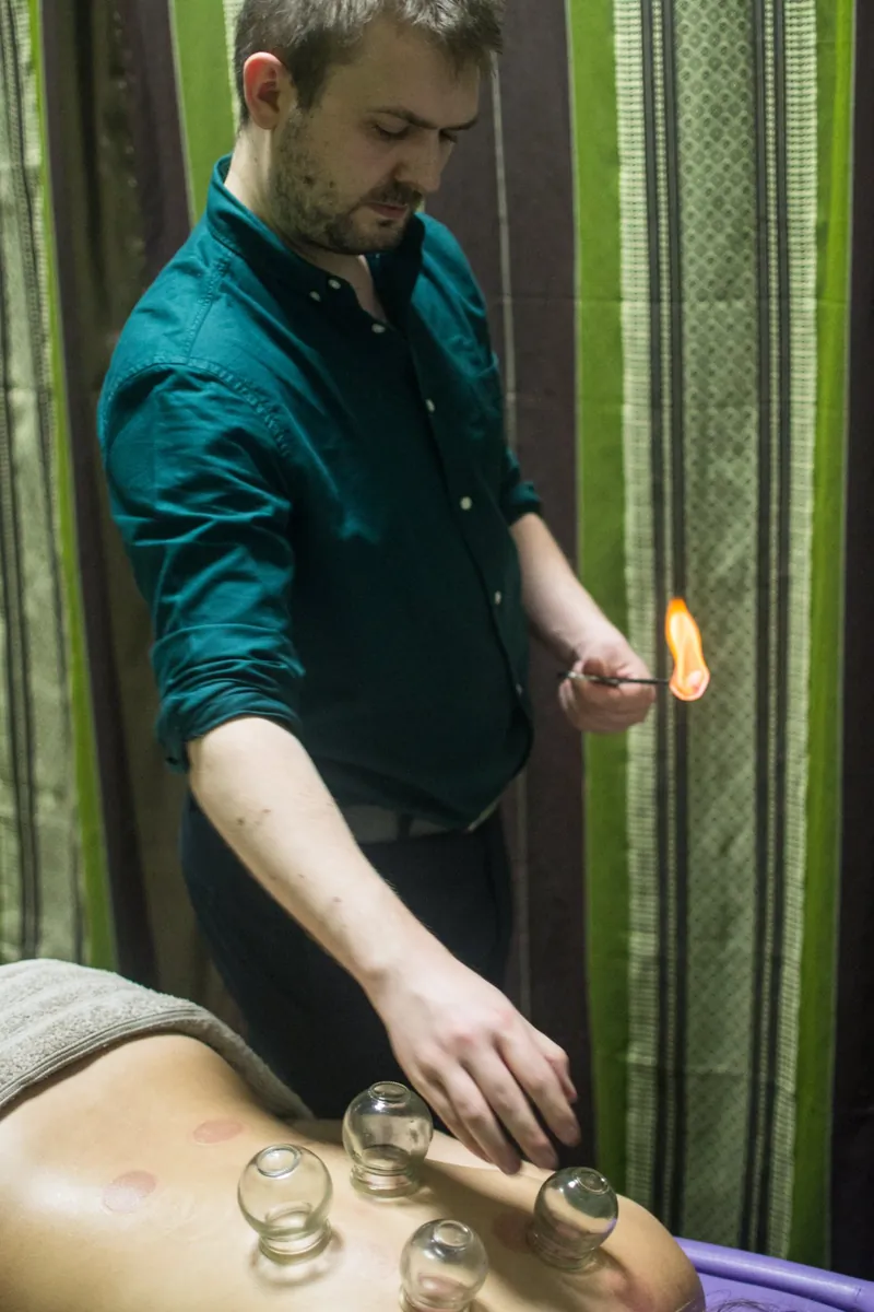 Ventouses à la flamme : Aymeric tient une flamme près des ventouses en verre posées sur le dos d’un client